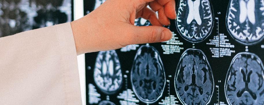 Imagen ilustrativa de una exploración cerebral en un entorno clínico.